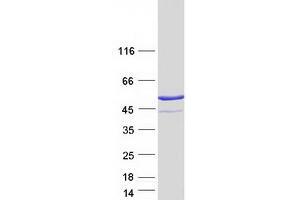Validation with Western Blot (PRKAR1A Protein (Transcript Variant 2) (Myc-DYKDDDDK Tag))