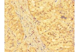 Immunohistochemistry of paraffin-embedded human adrenal gland tissue using ABIN7157336 at dilution of 1:100 (KRTAP23-1 抗体  (AA 1-65))