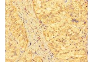 Immunohistochemistry of paraffin-embedded human adrenal gland tissue using ABIN7157336 at dilution of 1:100