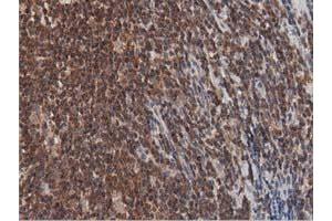 Image no. 10 for anti-DnaJ (Hsp40) Homolog, Subfamily A, Member 2 (DNAJA2) antibody (ABIN1497858)