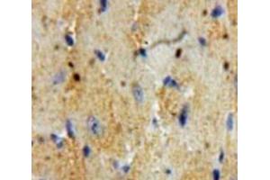 IHC-P analysis of Heart tissue, with DAB staining. (Cardiac Troponin T2 抗体  (AA 2-100))
