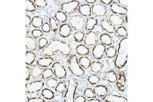 Immunohistochemistry of paraffin-embedded rat kidney using VEGFB Rabbit pAb (ABIN6128909, ABIN6150090, ABIN6150092 and ABIN6216417) at dilution of 1:150 (40x lens). (VEGFB 抗体  (AA 25-207))