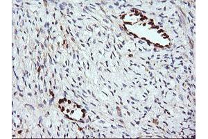 Image no. 1 for anti-ERG, ETS transcription factor (ERG) antibody (ABIN1498076) (ERG 抗体)