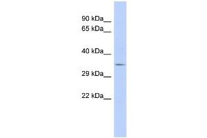WB Suggested Anti-TRIM34 Antibody Titration:  0. (TRIM34 抗体  (N-Term))