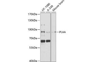 Western blot analysis of extracts of various cell lines, using PLAA antibody (ABIN1682194, ABIN3018787, ABIN3018788 and ABIN6220577) at 1:1000 dilution. (PLAA 抗体  (AA 536-795))