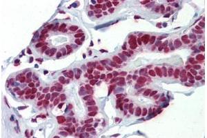 Human Breast (formalin-fixed, paraffin-embedded) stained with FUS antibody ABIN462224 followed by biotinylated goat anti-rabbit IgG secondary antibody ABIN481713, alkaline phosphatase-streptavidin and chromogen. (FUS 抗体  (N-Term))