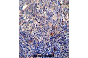 Immunohistochemistry (Paraffin-embedded Sections) (IHC (p)) image for anti-B-Cell CLL/lymphoma 10 (BCL10) (AA 27-55), (N-Term) antibody (ABIN950621)