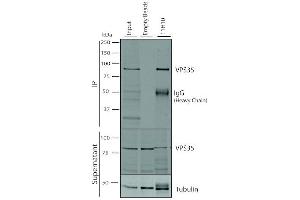 Immunoprecipitation analysis using Mouse Anti-VPS35 Monoclonal Antibody, Clone 11H10 (ABIN6933016). (VPS35 抗体  (Biotin))