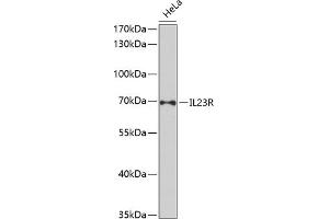 Western Blotting (WB) image for anti-Interleukin 23 Receptor (IL23R) (AA 405-629) antibody (ABIN3022246)