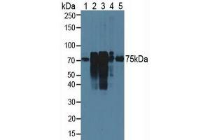Western blot analysis of (1) Rat Serum, (2) Rat Lung Tissue, (3) Rat Placenta Tissue, (4) Rat Uterus Tissue and (5) Human HeLa cells. (Cortactin 抗体  (AA 1-509))