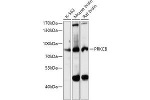 Western blot analysis of extracts of various cell lines, using PRKCB antibody (ABIN6128463, ABIN6146200, ABIN6146202 and ABIN6221544) at 1:3000 dilution. (PKC beta 抗体  (AA 220-340))