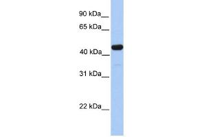 WB Suggested Anti-GAL3ST3 Antibody Titration:  0. (GAL3ST3 抗体  (C-Term))