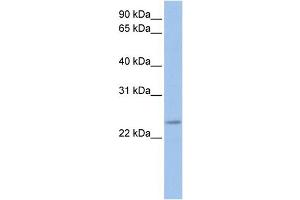 WB Suggested Anti-FKBP3  Antibody Titration: 0. (FKBP3 抗体  (C-Term))