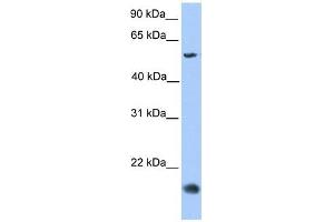 CMTM8 antibody used at 1 ug/ml to detect target protein. (CMTM8 抗体  (Middle Region))