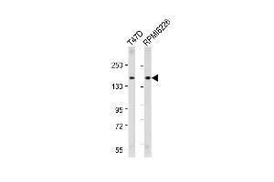 All lanes : Anti-ABCC12 Antibody (Center) at 1:2000 dilution Lane 1: T47D whole cell lysate Lane 2: R whole cell lysate Lysates/proteins at 20 μg per lane. (ABCC12 抗体  (AA 723-752))