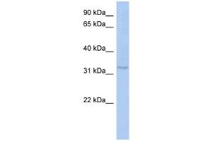 C10ORF96 antibody used at 1 ug/ml to detect target protein. (C10ORF96 抗体  (Middle Region))