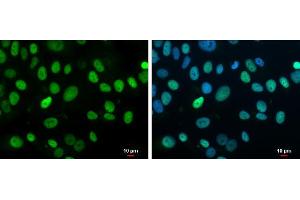 ICC/IF Image Rb antibody detects Rb protein at nucleus by immunofluorescent analysis. (Retinoblastoma 1 抗体  (C-Term))