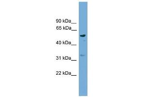 WB Suggested Anti-RSAD1 Antibody Titration: 0.