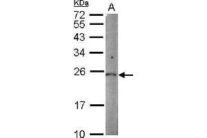 WB Image Sample (50 ug of whole cell lysate) A: mouse kidney 12% SDS PAGE antibody diluted at 1:1000 (PGPEP1 抗体)