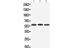 Western Blotting (WB) image for anti-Dopamine Receptor D5 (DRD5) (AA 388-407), (C-Term) antibody (ABIN3042836) (DRD5 抗体  (C-Term))