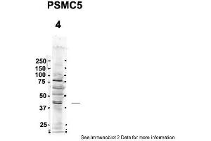 Sample Type: 4. (PSMC5 抗体  (C-Term))