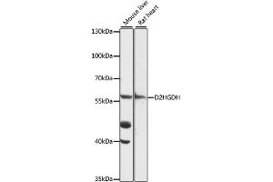 Western blot analysis of extracts of various cell lines, using D2HGDH antibody (ABIN7266669) at 1:1000 dilution. (D2HGDH 抗体  (AA 322-521))