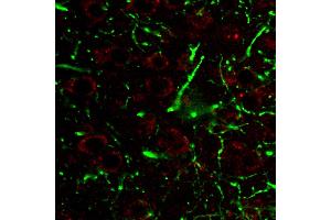 Immunohistochemistry staining of CD107a (red) in tissue sections of murine brain expressing GFP in some of its neurons (green). (LAMP1 抗体)