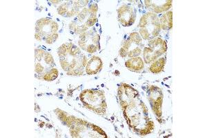 Immunohistochemistry of paraffin-embedded human stomach using PER1 antibody. (PER1 抗体  (AA 1-200))