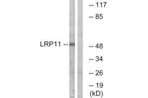 Western blot analysis of extracts from Jurkat cells, using LRP11 antibody. (LRP11 抗体)