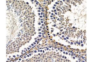 ABIN7096540 and ABIN7100604 at 1/100 staining rat testis tissue by IHC-P.