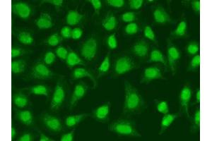 Immunofluorescence (IF) image for anti-Ligase III, DNA, ATP-Dependent (LIG3) antibody (ABIN3022649)