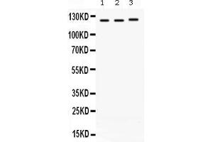 Western blot analysis of CRM1 expression in rat cardiac muscle extract ( Lane 1), mouse brain extract ( Lane 2) and A549 whole cell lysates ( Lane 3). (XPO1 抗体  (AA 966-1071))