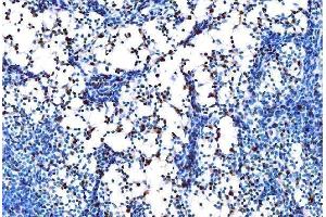 anti-Spleen Focus Forming Virus (SFFV) Proviral Integration Oncogene Spi1 (SPI1) (AA 1-212) antibody
