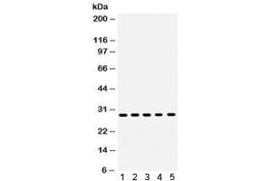 Western blot testing of human 1) MCF7, 2) MM231, 3) MM453, 4) SKOV and 5) HeLa lysate with XBP1 antibody. (XBP1 抗体)