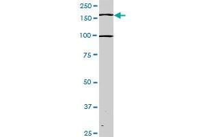Western Blotting (WB) image for anti-TEK Tyrosine Kinase, Endothelial (TEK) (AA 66-185) antibody (ABIN793004) (TEK 抗体  (AA 66-185))