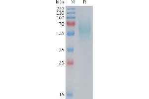 Trophoblast Glycoprotein (TPBG) (AA 32-361) protein (His tag)