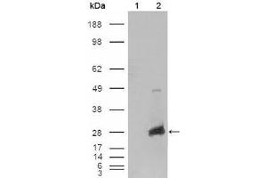 Western Blot showing CRYAB antibody used against HEK293T cells transfected with the pCMV6-ENTRY control (1) and pCMV6-ENTRY CRYAB cDNA (2). (CRYAB 抗体  (AA 1-175))