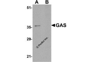Western Blotting (WB) image for anti-Gastrin (GAST) (C-Term) antibody (ABIN1030407)