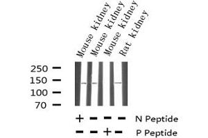 Western blot analysis of Phospho-eNOS (Thr494) expression in various lysates (ENOS 抗体  (pThr495))