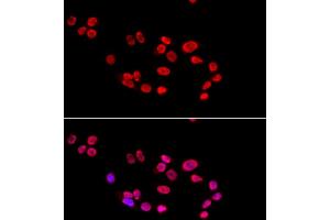 Immunofluorescence analysis of HeLa cells using XRCC5 antibody. (XRCC5 抗体)