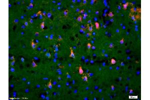 Formalin-fixed and paraffin-embedded rat brain labeled with Anti-Phospho-TAK1(Thr184/187) Polyclonal Antibody, Unconjugated (ABIN746348) 1:200, overnight at 4°C, The secondary antibody was Goat Anti-Rabbit IgG, Cy3 conjugated used at 1:200 dilution for 40 minutes at 37°C. (TR4 抗体  (pThr184, pThr187))
