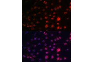 Immunofluorescence analysis of C6 cells using CRM1/XPO1 antibody (ABIN7267067). (XPO1 抗体)