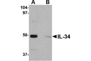 Western Blotting (WB) image for anti-Interleukin 34 (IL34) (Middle Region) antibody (ABIN1030960) (IL-34 抗体  (Middle Region))