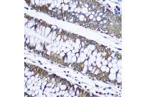 Immunohistochemistry of paraffin-embedded human placenta using Ubiquitin Rabbit pAb (ABIN3022990, ABIN3022991, ABIN3022992 and ABIN6219334) at dilution of 1:100 (40x lens). (Ubiquitin B 抗体  (AA 1-76))