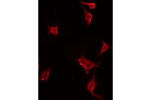 ABIN6274447 staining Hela by IF/ICC. (DUSP19 抗体  (Internal Region))