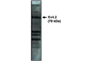 Western Blotting (WB) image for anti-Potassium Voltage-Gated Channel, Shal-Related Subfamily, Member 2 (KCND2) antibody (ABIN306877)