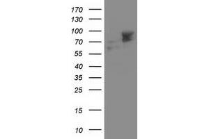 Western Blotting (WB) image for anti-Aldehyde Dehydrogenase 3 Family, Member A2 (ALDH3A2) antibody (ABIN1496596) (ALDH3A2 抗体)