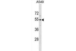 Western Blotting (WB) image for anti-Pseudouridylate Synthase 10 (PUS10) antibody (ABIN5020829) (PUS10 抗体)