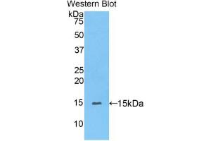 Western blot analysis of the recombinant protein. (PPARD 抗体  (AA 29-147))