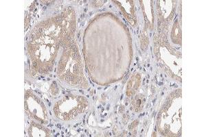 ABIN6267538 at 1/200 staining human kidney tissue sections by IHC-P. (PLA2G4A 抗体  (pSer505))